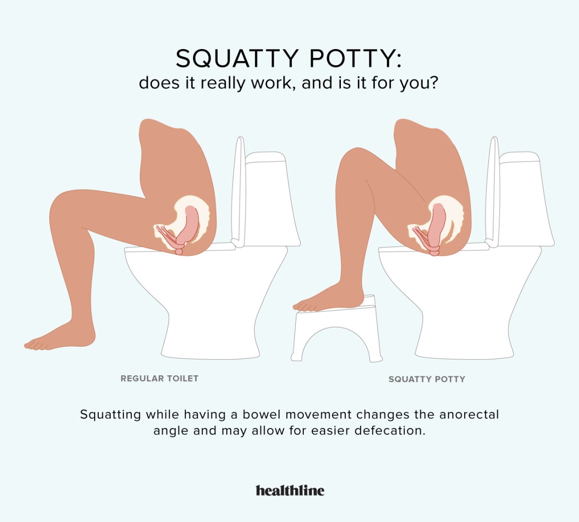 Does the Squatty Potty Actually Work?